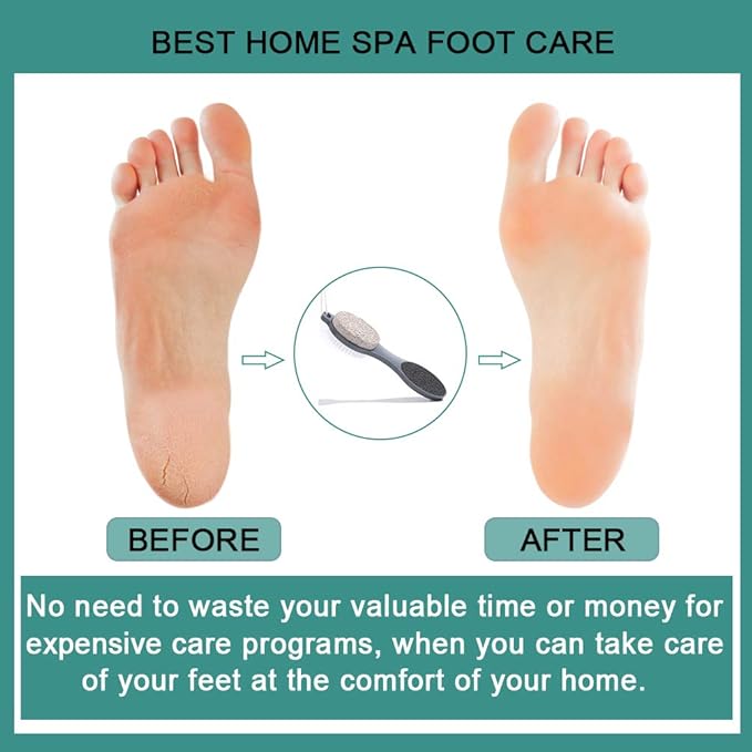 thumbnail image 4 of Lima para pies YONGSHENG herramientas de PEDICURA multiusos 4 en 1, 4 of 5