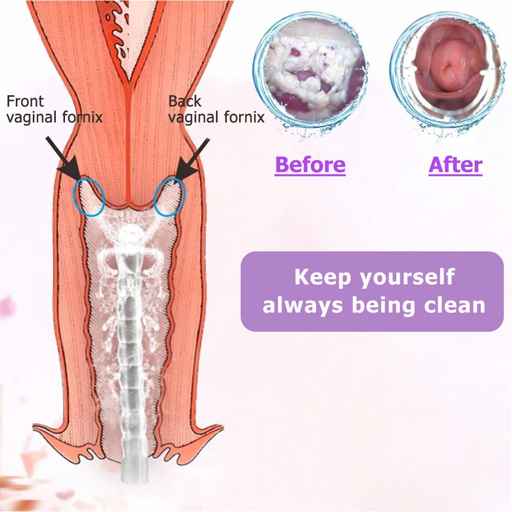 thumbnail image 2 of Sistema de limpieza vaginal natural de 300 ml, limpiador de ducha vaginal, kit de limpieza vaginal de ducha anal para limpieza/desintoxicación de colon, 2 of 4
