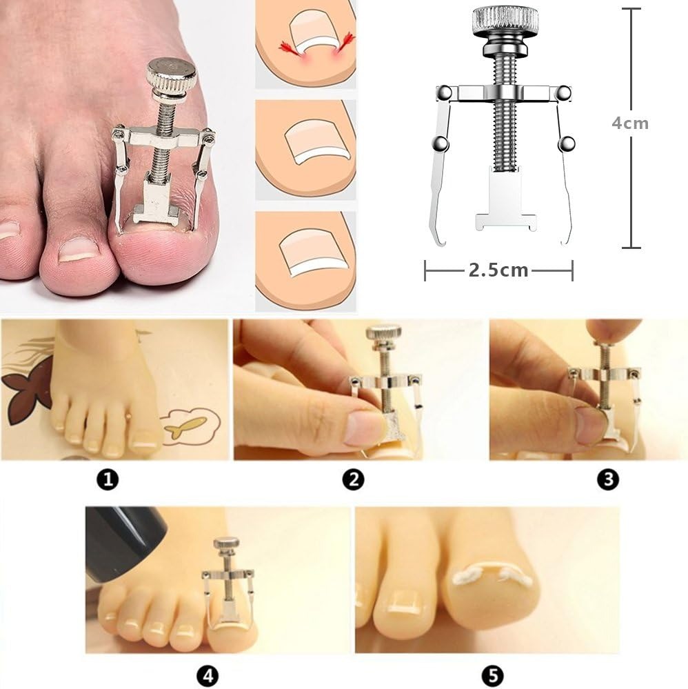 thumbnail image 4 of Juego de lima y levantador de uñas de los pies, 6 piezas, juego profesional de cuidado de uñas, kit de cuchillos de pedicura con cortaúñas de grado médico para uñas gruesas y encarnadas (6 ~, 4 of 5